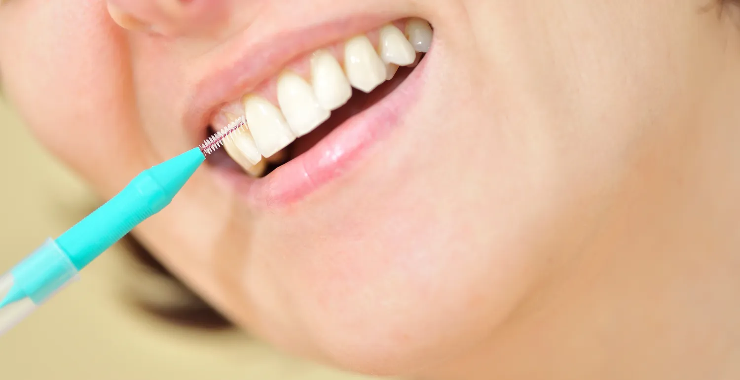 Na czym polega leczenie kanałowe?