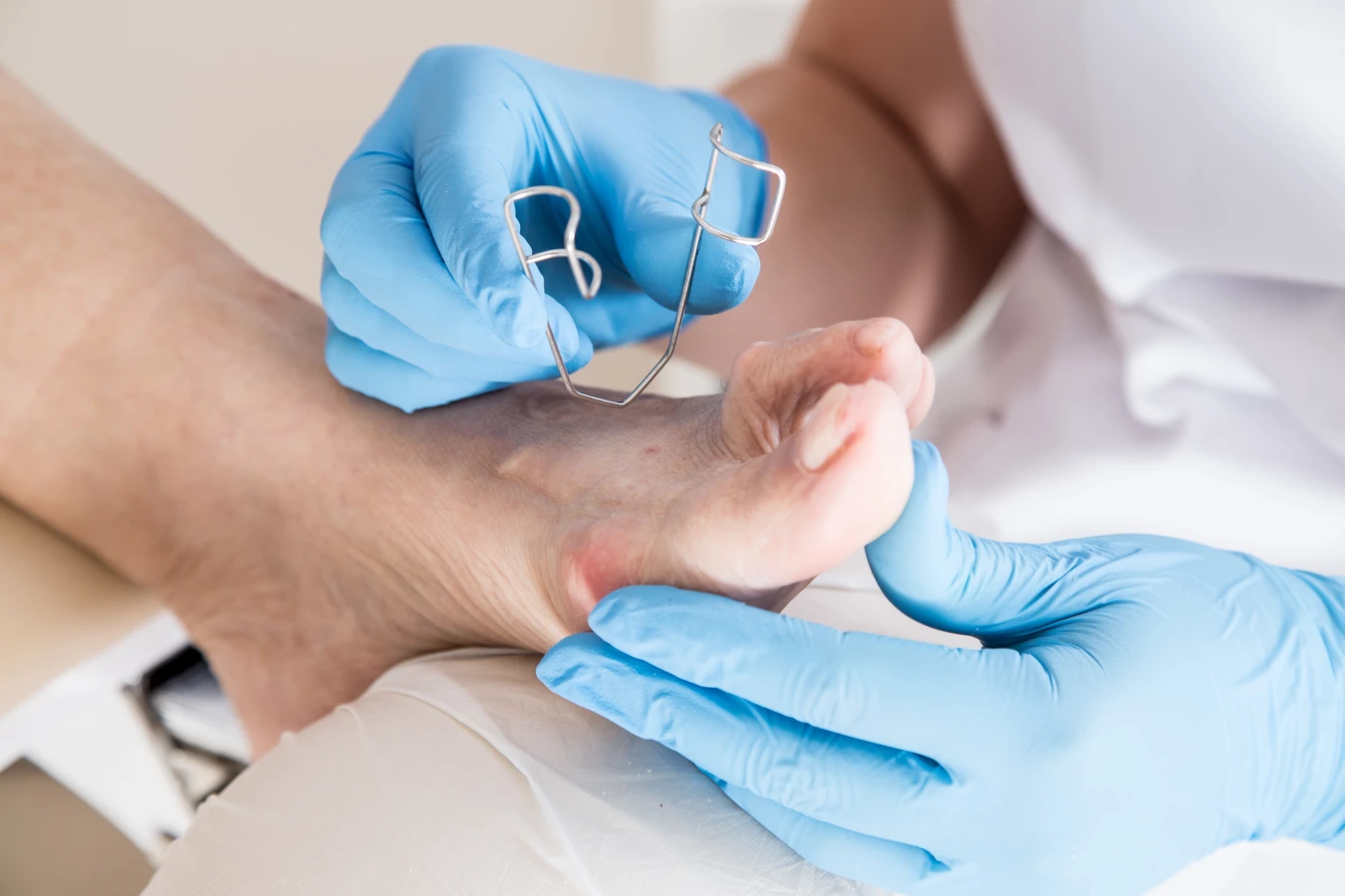 Czym jest pedicure leczniczy oraz na czym dokładnie polega?