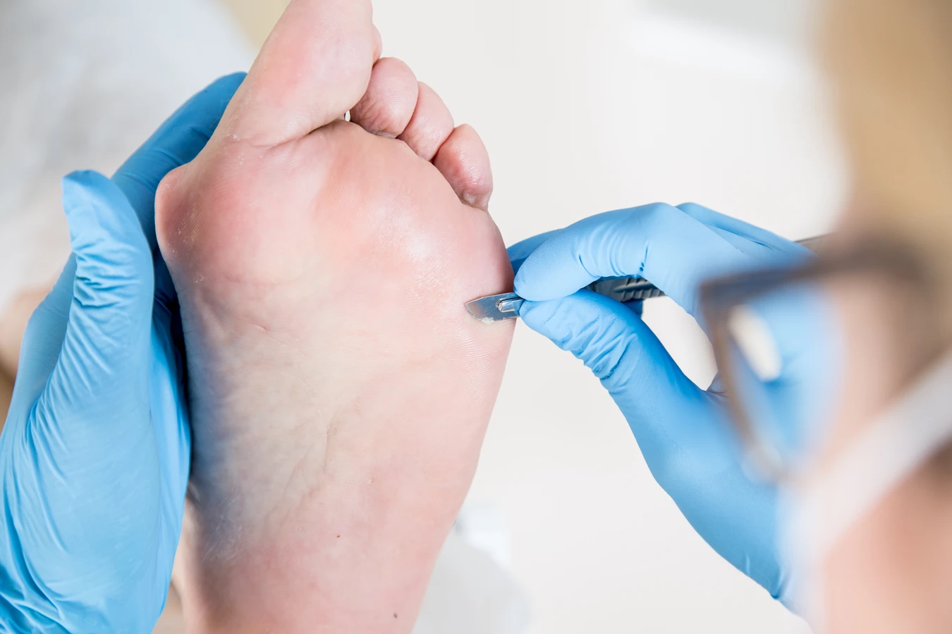 Podologia - jakie problemy zdrowotne rozwiązuje?