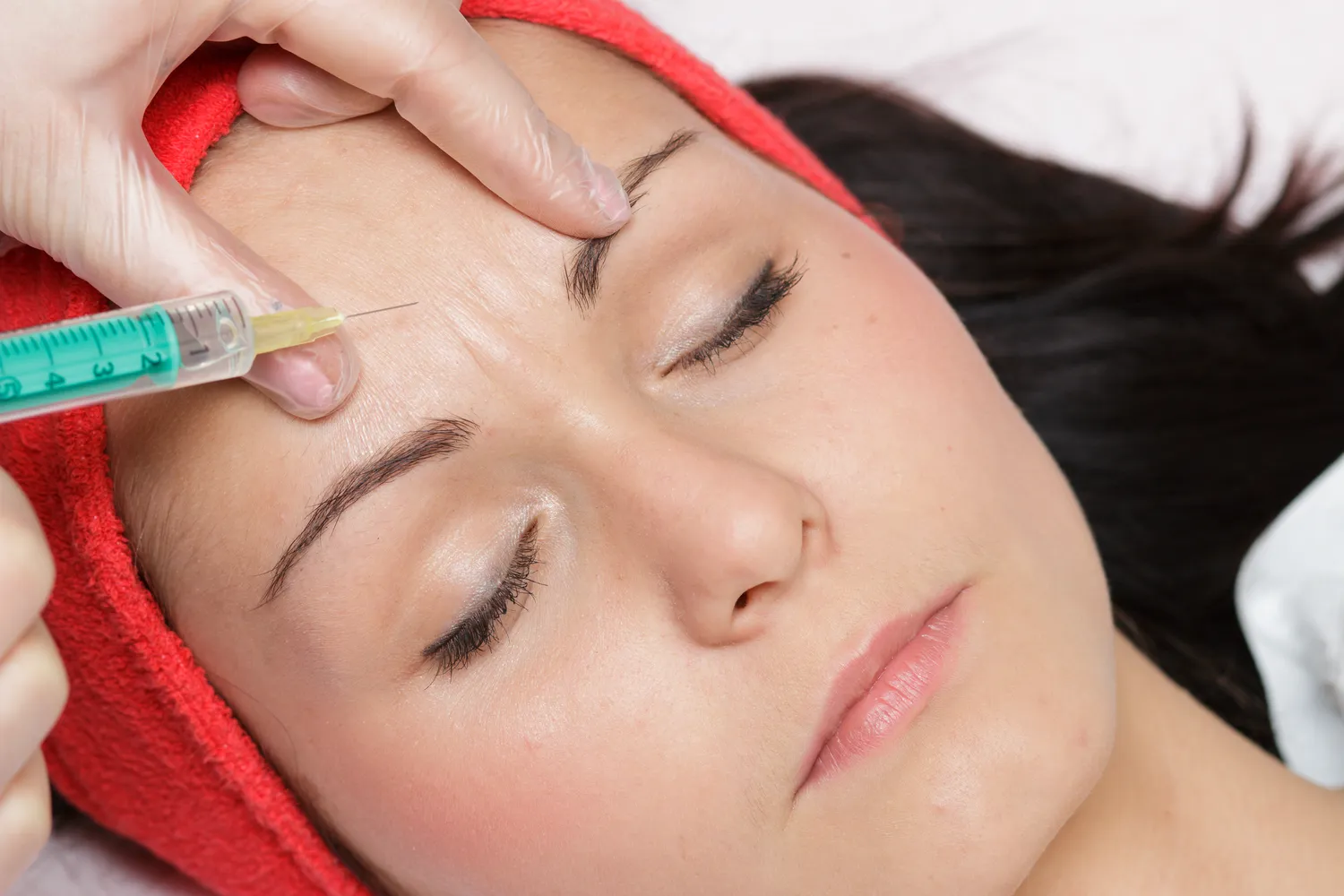 Jak długo układa się kwas hialuronowy w policzkach?